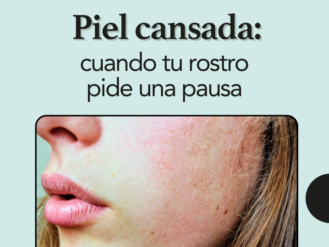 Piel cansada: cuando tu rostro pide una pausa (no más productos)